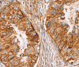 CD59 Polyclonal Antibody - 3