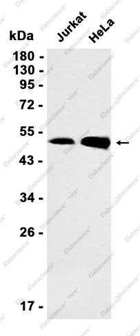 Recombinant SMYD3 Monoclonal Antibody - 1