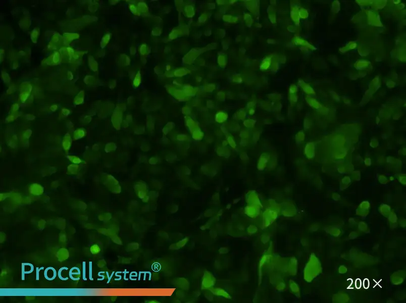 PC-3-GFP Cell Complete Medium - 2