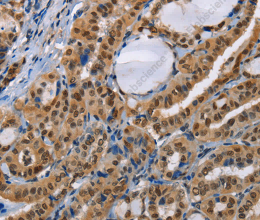 BAG1 Polyclonal Antibody - 2