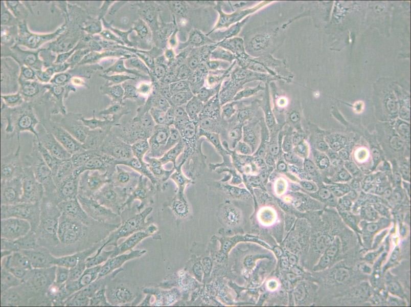 NCI-H1568 [H1568] Cell Complete Medium - small - 4