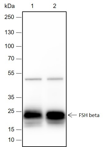 Recombinant FSH beta Monoclonal Antibody-searchlist-1