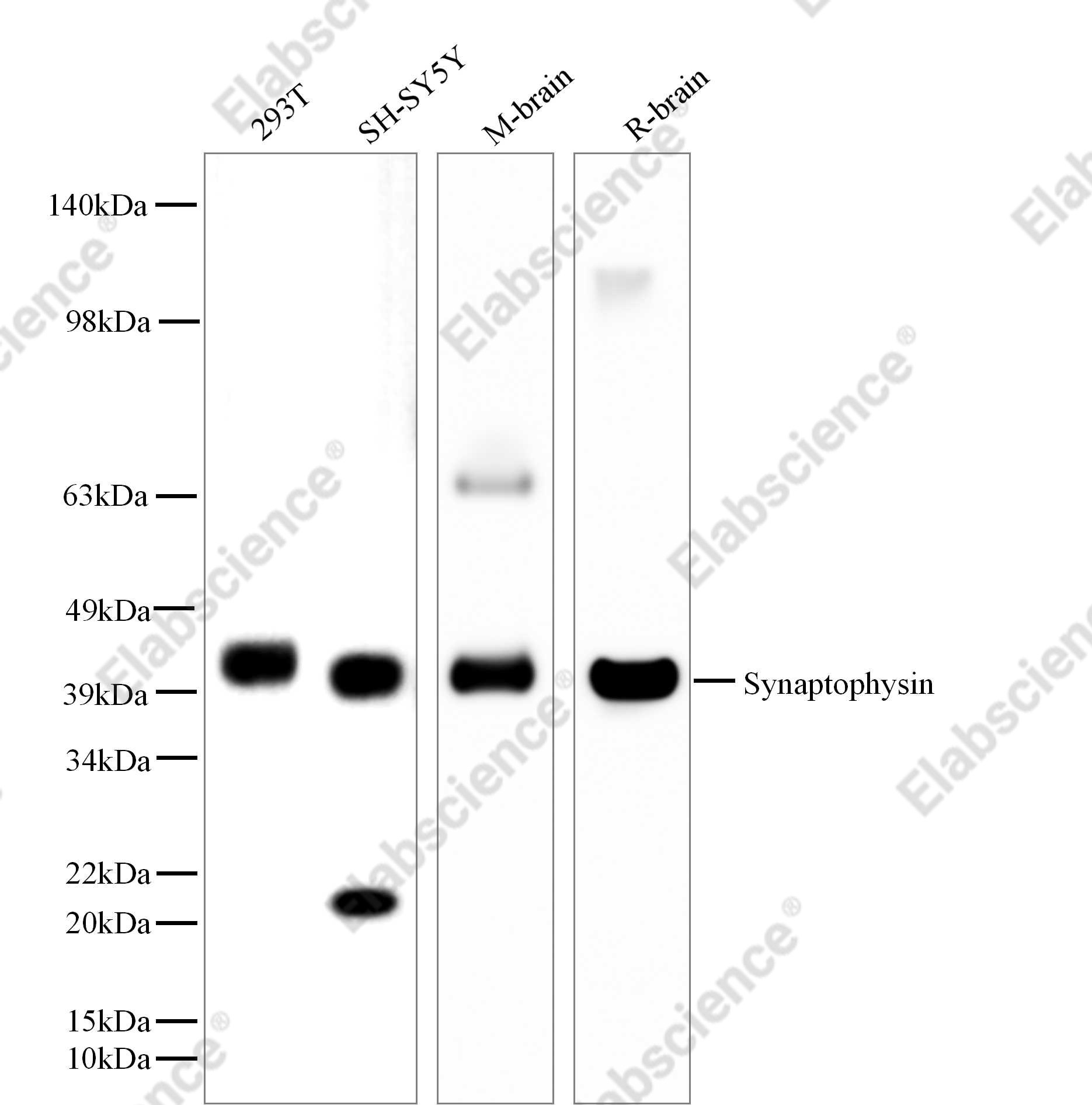 Recombinant Synaptophysin Monoclonal Antibody - 1