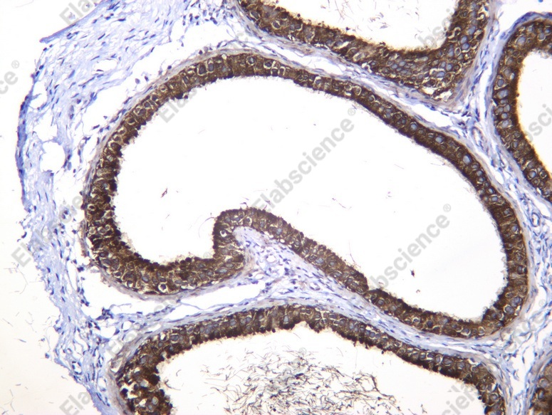 Recombinant Uroplakin III Monoclonal Antibody - 3