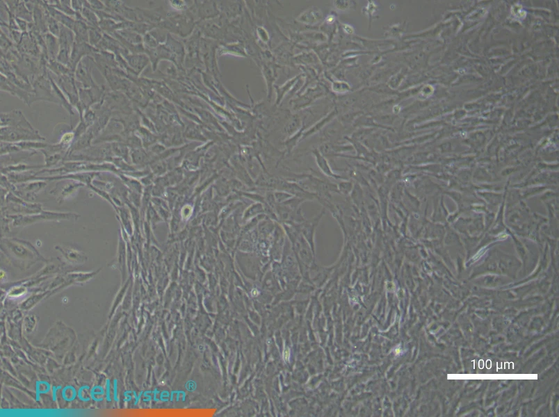 Mouse Cerebral Artery Smooth Muscle Cell Complete Medium - 2