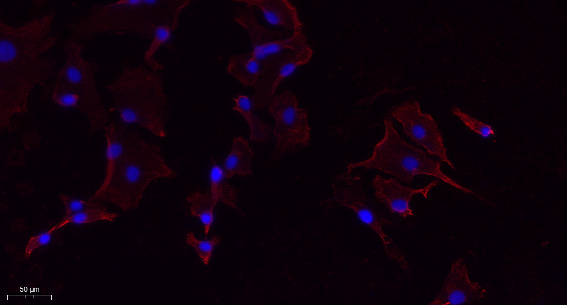 Recombinant PERK Monoclonal Antibody - 3
