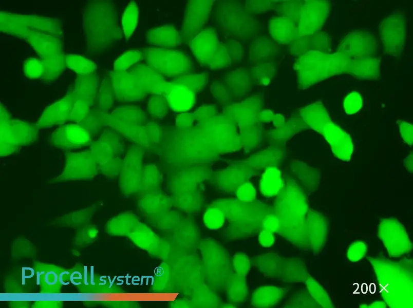 NCI-H446-LUC-EGFP Cell Complete Medium - 6