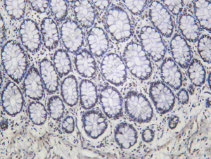 Recombinant Ku-80 Monoclonal Antibody - 1