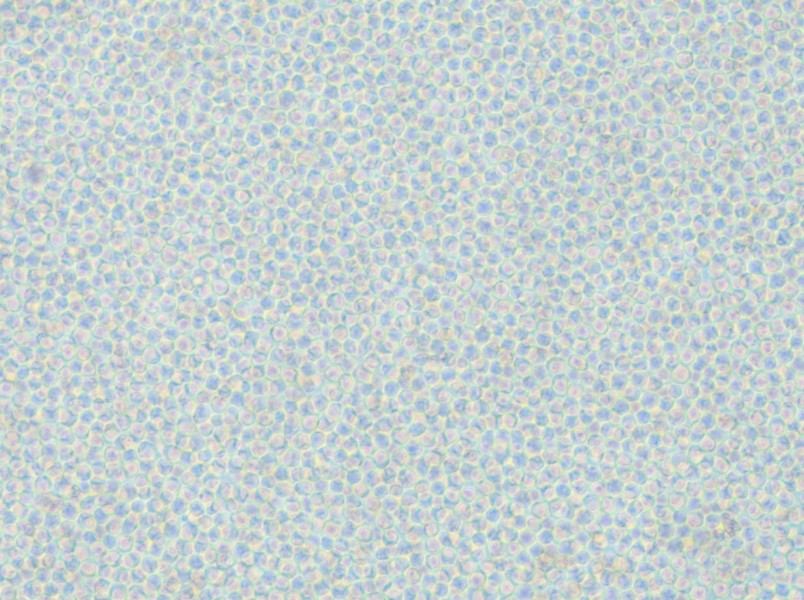 OCI-AML-2 Cell Complete Medium - small - 6