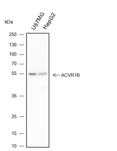 Recombinant Activin A Receptor Type IB/ALK-4 Monoclonal Antibody-searchlist-1
