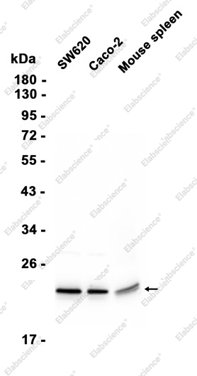 Recombinant RAB22A Monoclonal Antibody - 2