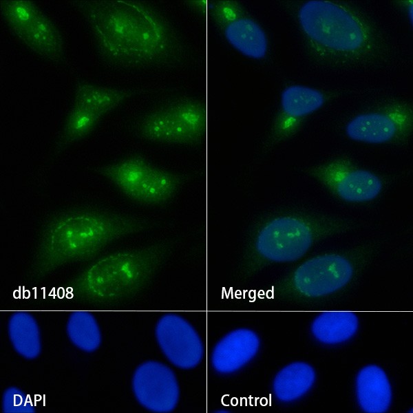 Recombinant PA28A/PSME1 Monoclonal Antibody - 2