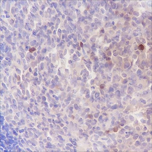 Recombinant ELP3 Monoclonal Antibody - 2