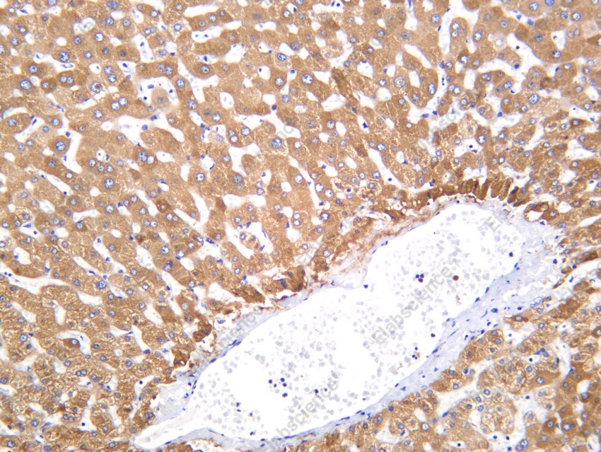 Recombinant MBL2 Monoclonal Antibody - 2