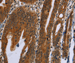GH2 Polyclonal Antibody - 3
