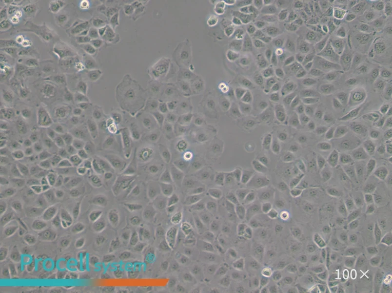 NIH:OVCAR-3 [OVCAR3] Cell Complete Medium - 1