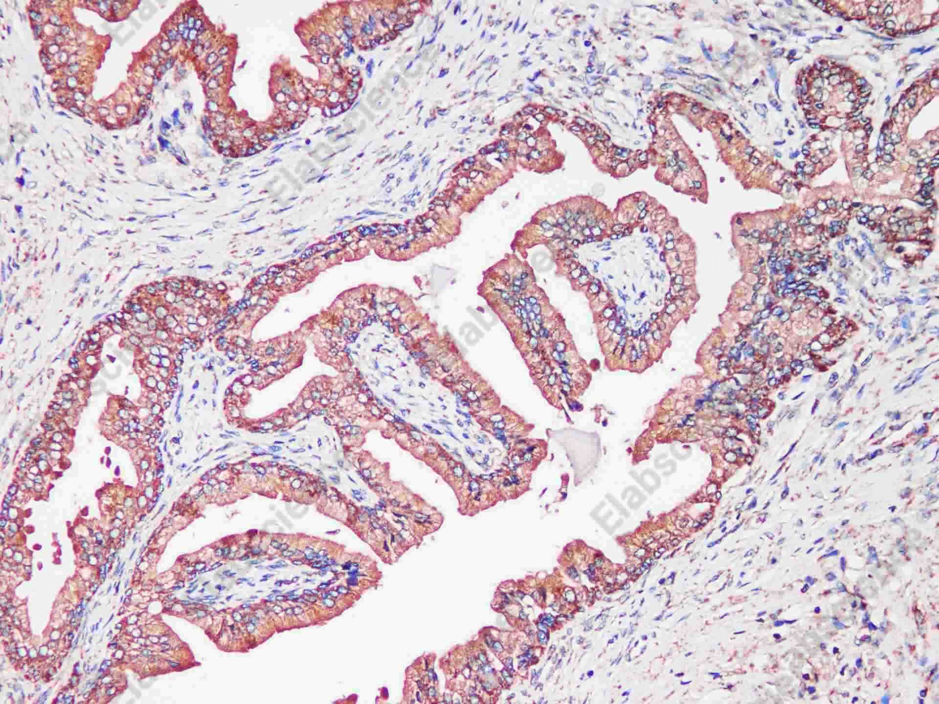 Tf Polyclonal Antibody - 3