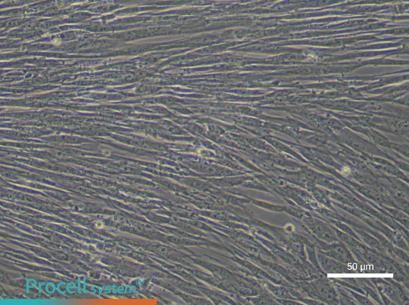Human Lung Cancer‑Associated Fibroblast Complete Medium - 6