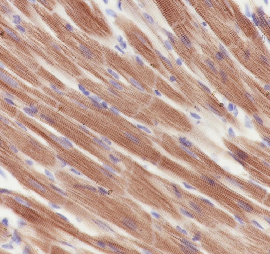 Recombinant APAF1 Monoclonal Antibody - small - 4