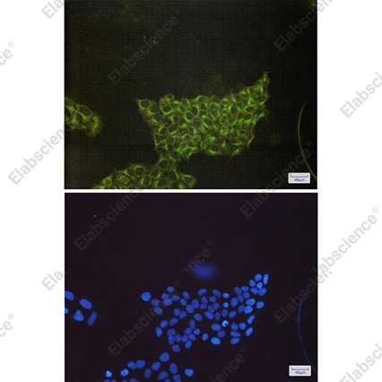 Recombinant S6K1 Monoclonal Antibody - 4