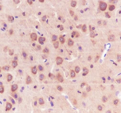 Recombinant 14-3-3 gamma Monoclonal Antibody - small - 2