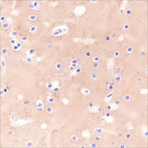 Recombinant Prion protein PrP Monoclonal Antibody - small - 2