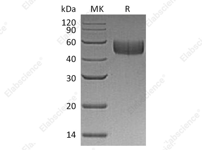 Recombinant Human SIRPB1/CD172b Protein (His Tag) - 1
