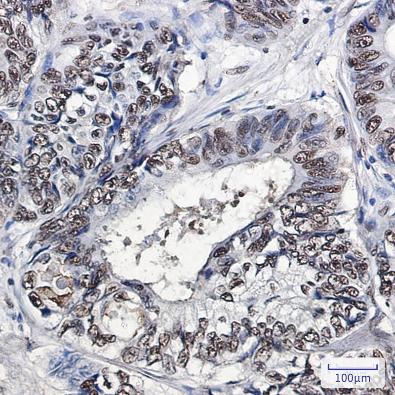 Recombinant PHAPI2 Monoclonal Antibody - 3