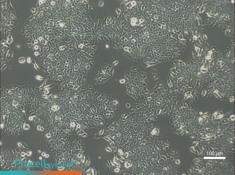 JIMT-1 Cell Complete Medium - 3