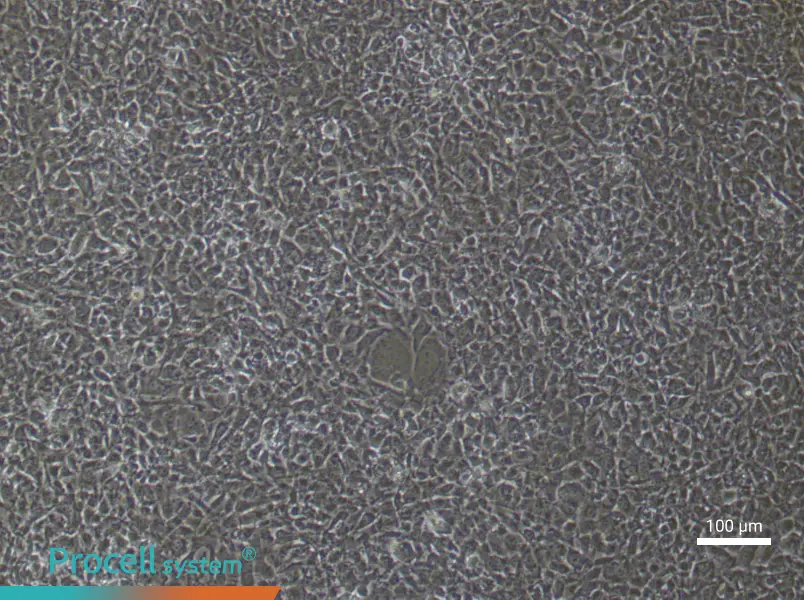 Mouse Pulmonary Microvascular Endothelial (Primary cell immortalization) Cell Complete MediumMouse Pulmonary Microvascular Endothelial (Primary cell immortalization) Cell Complete Medium - 1