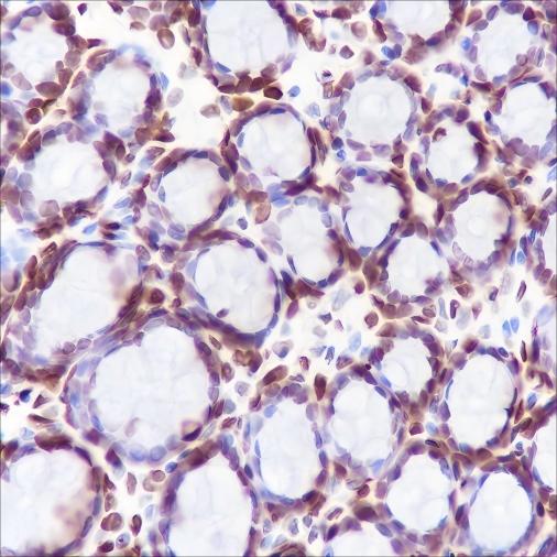 Recombinant CENP-A Monoclonal Antibody - small - 4