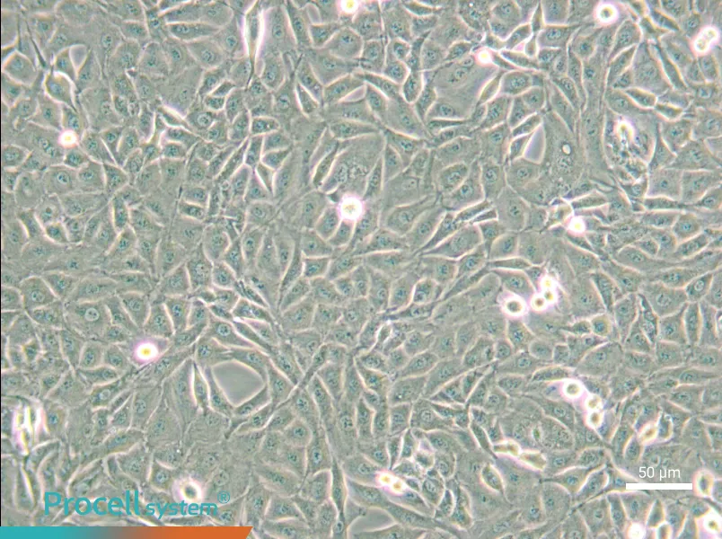 9L/lacZ Cell Complete Medium - small - 6