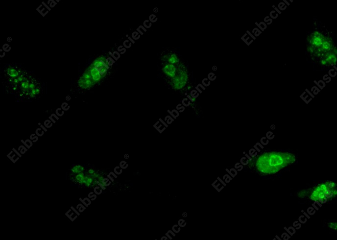 MKI67 Monoclonal Antibody - 1