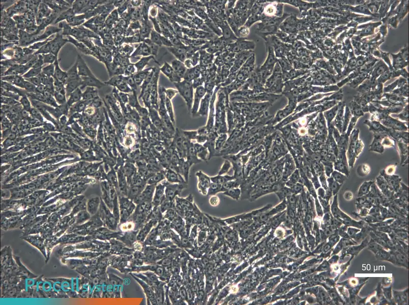 Y1 [Y-1] Cell Complete Medium - small - 4