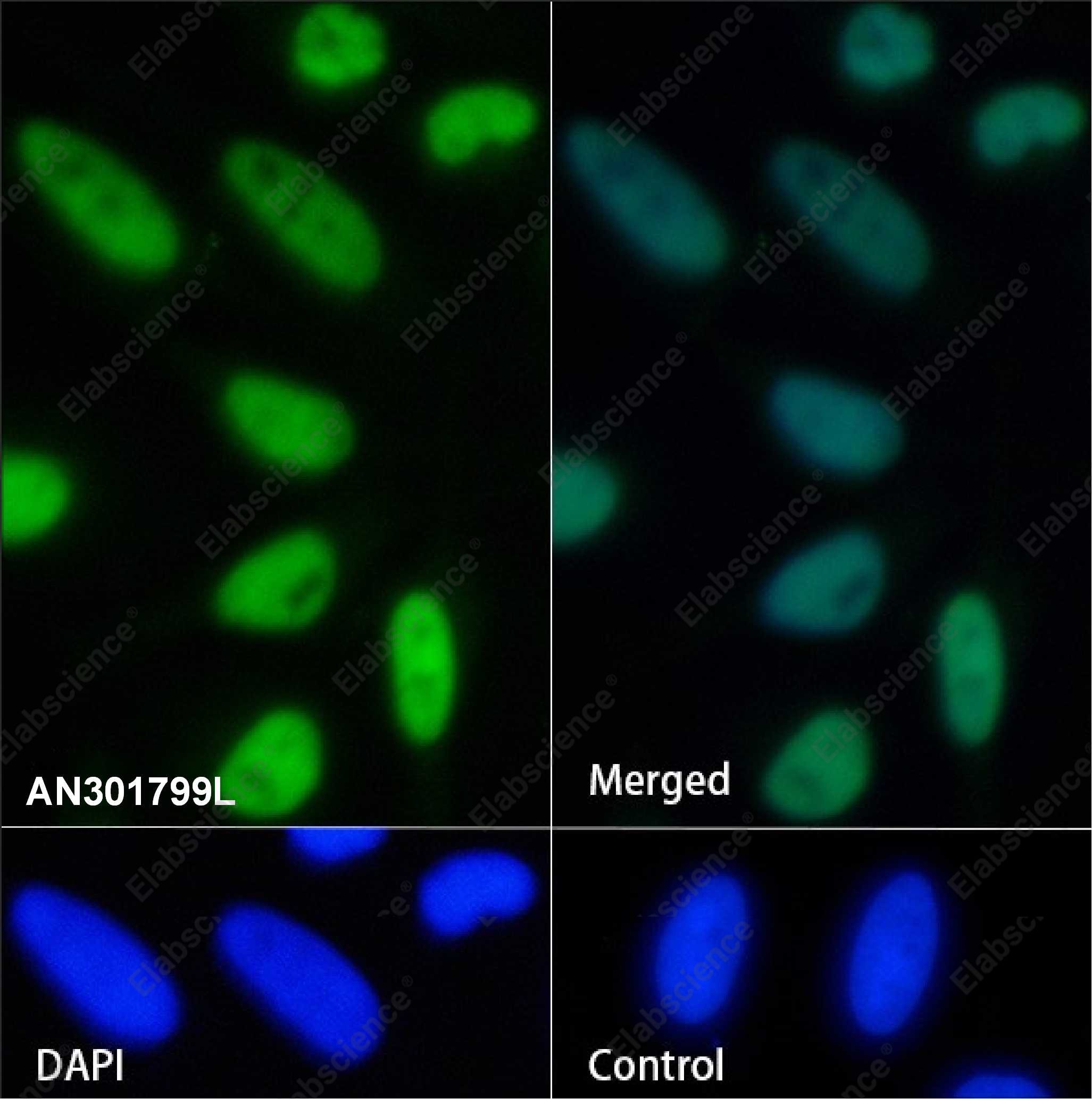 Recombinant SMARCD1 Monoclonal Antibody - 3