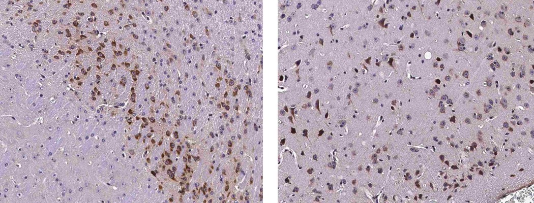 Recombinant Neuroserpin/SerpinI1 Monoclonal Antibody-searchlist-1