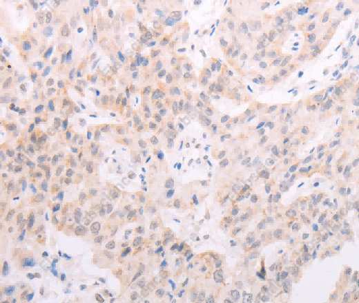 TYR Polyclonal Antibody - 3