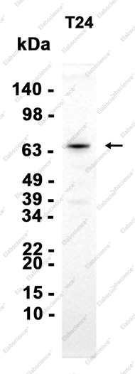 Recombinant IGF2BP1 Monoclonal Antibody - 2