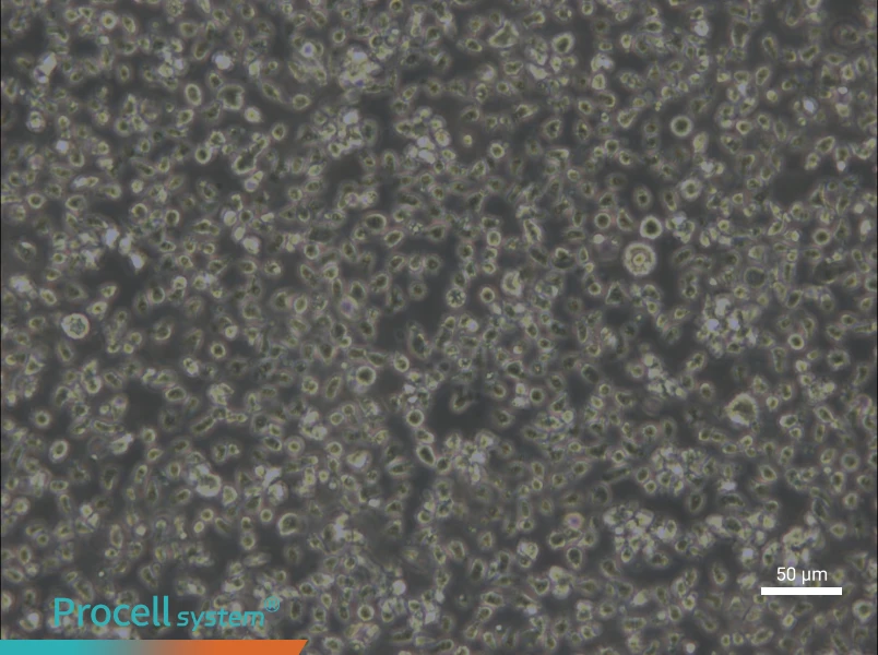 MEC-1 Cell Complete Medium - small - 5