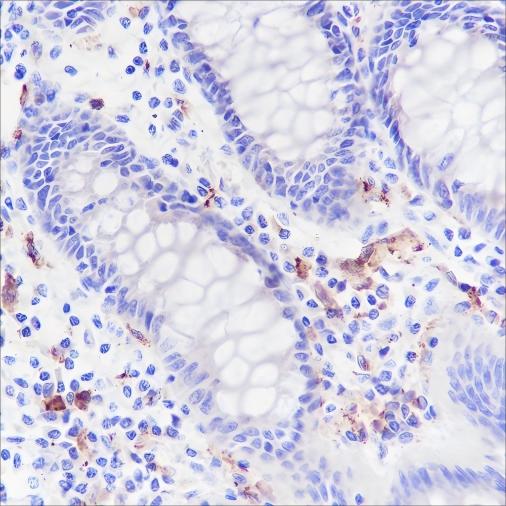 Recombinant CD169 Monoclonal Antibody-searchlist-1