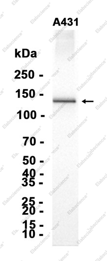 Recombinant MYO1B Monoclonal Antibody - 2