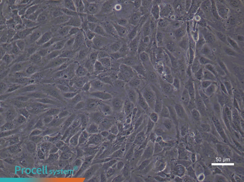 Human Pulmonary Microvascular Endothelial (Primary cell immortalization) Cell Complete MediumHuman Pulmonary Microvascular Endothelial (Primary cell immortalization) Cell Complete Medium - 6