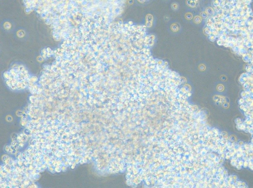 NCI-H2171 Cell Complete Medium - 12