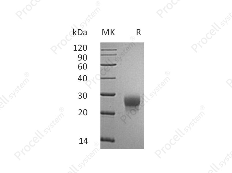 G-CSF/CSF3 (C-6His), Mouse, Recombinant