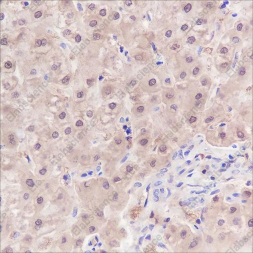 Recombinant SETBP1 Monoclonal Antibody - 3