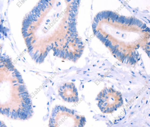 AADAC Polyclonal Antibody - 2