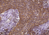 FGFR1/CD331 Monoclonal Antibody - small - 2