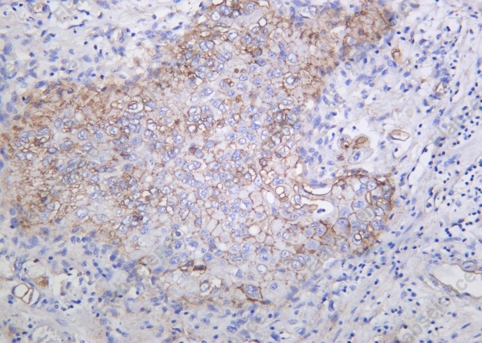 Recombinant Integrin αV Monoclonal Antibody - 1