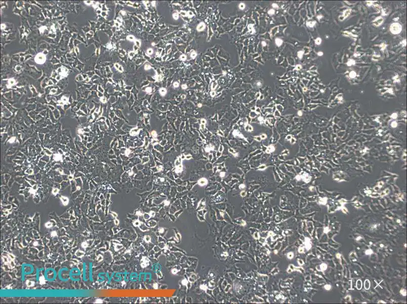 Ishikawa Cell Complete Medium - 3