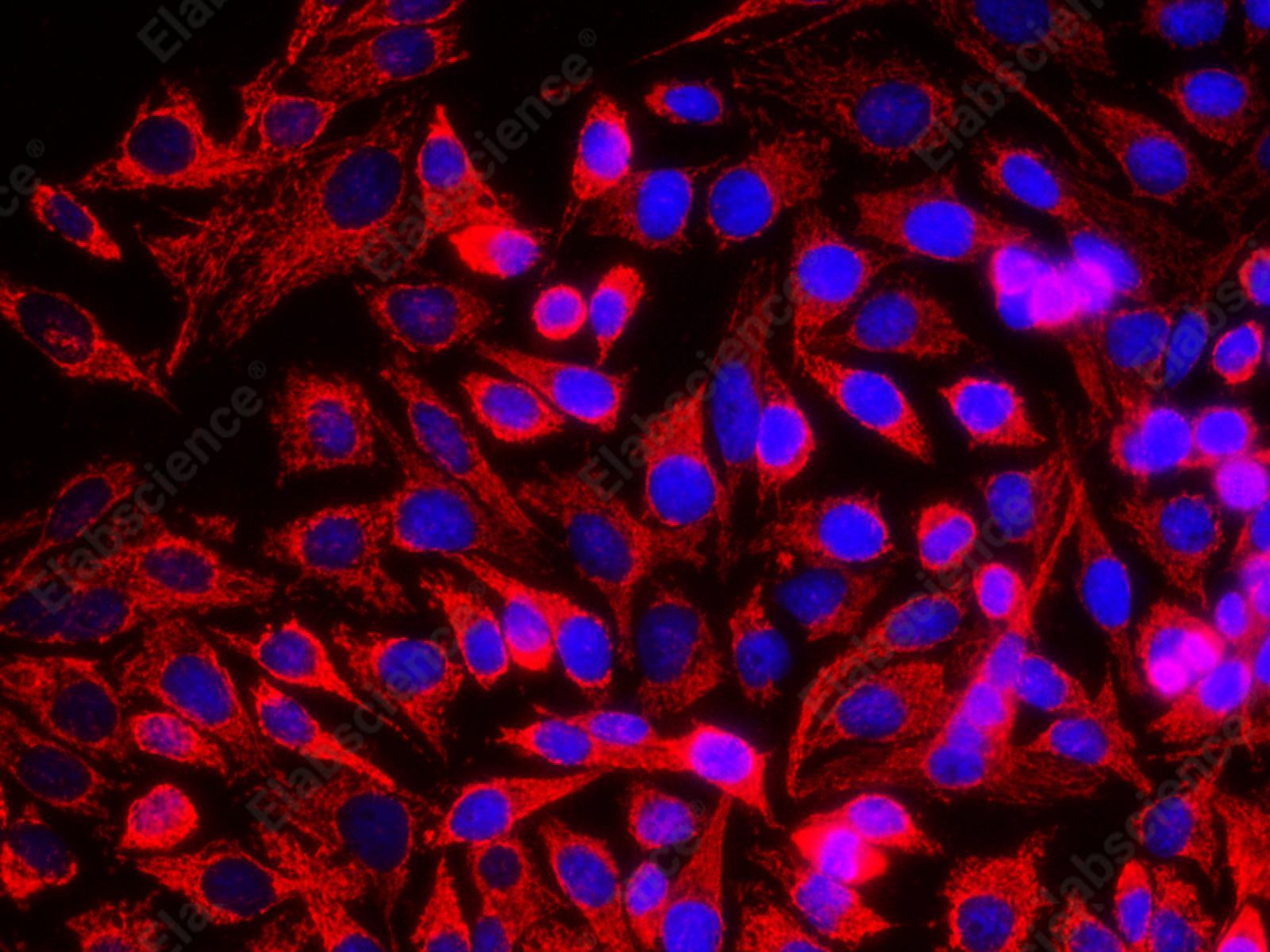 HSP-60 Polyclonal Antibody - 6
